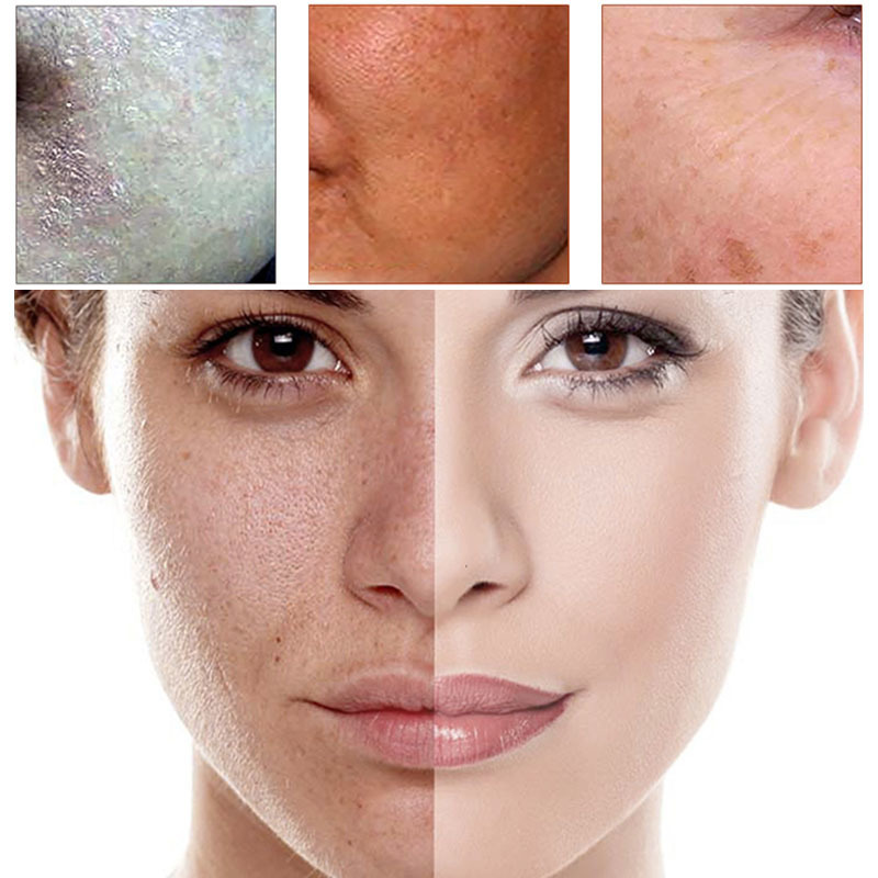 Repair Hyaluronic Acid Serum - Image 2