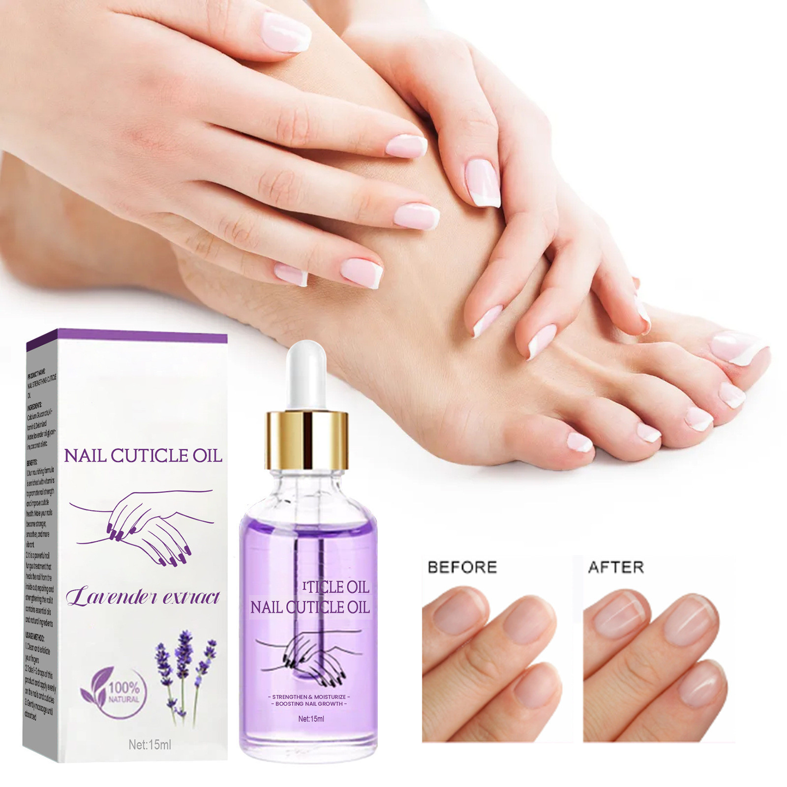 Nail Strengthening Repair Onychomycosis Cuticle Oil