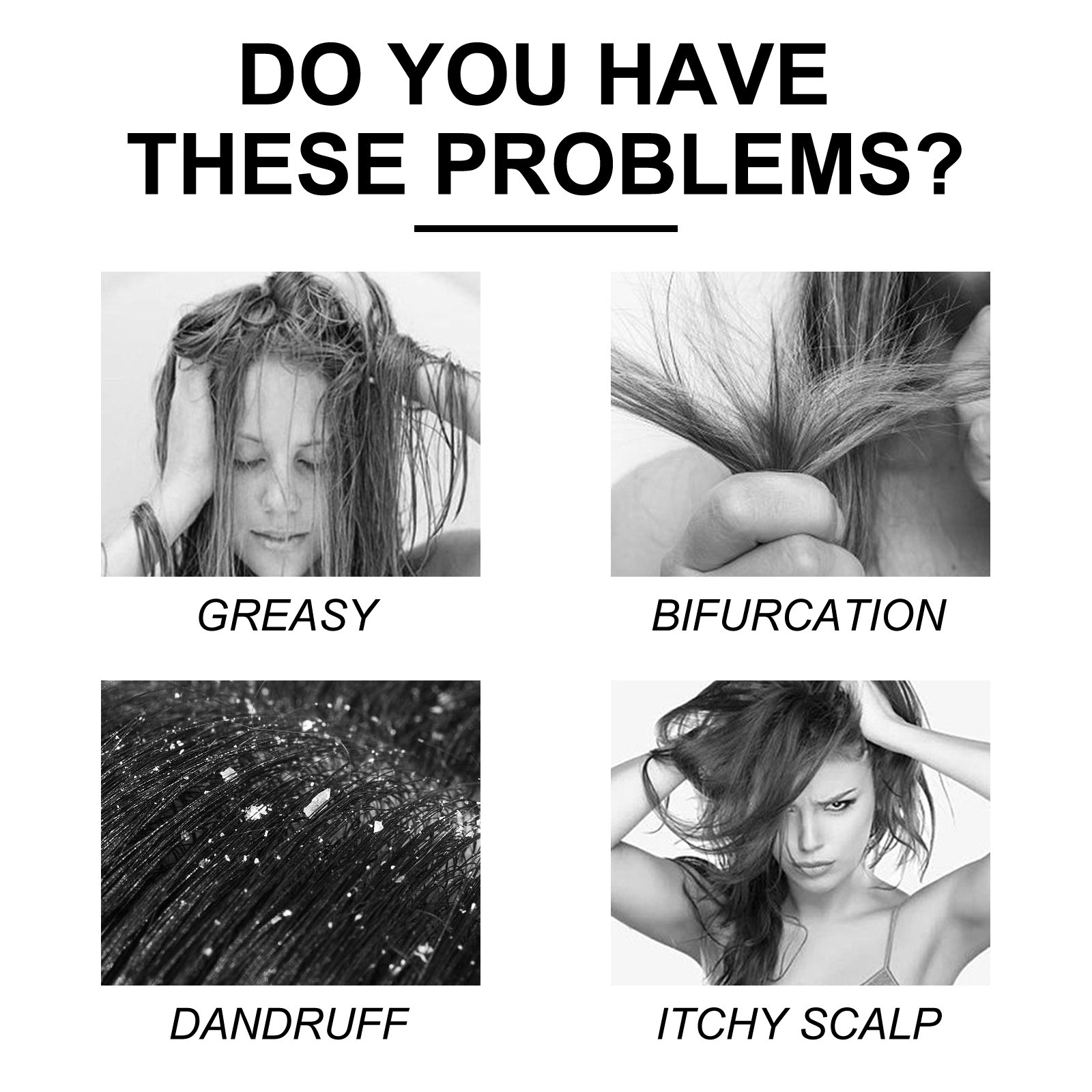 Soft Fluffy Cleansing Scalp Dandruff Shampoo - Image 5
