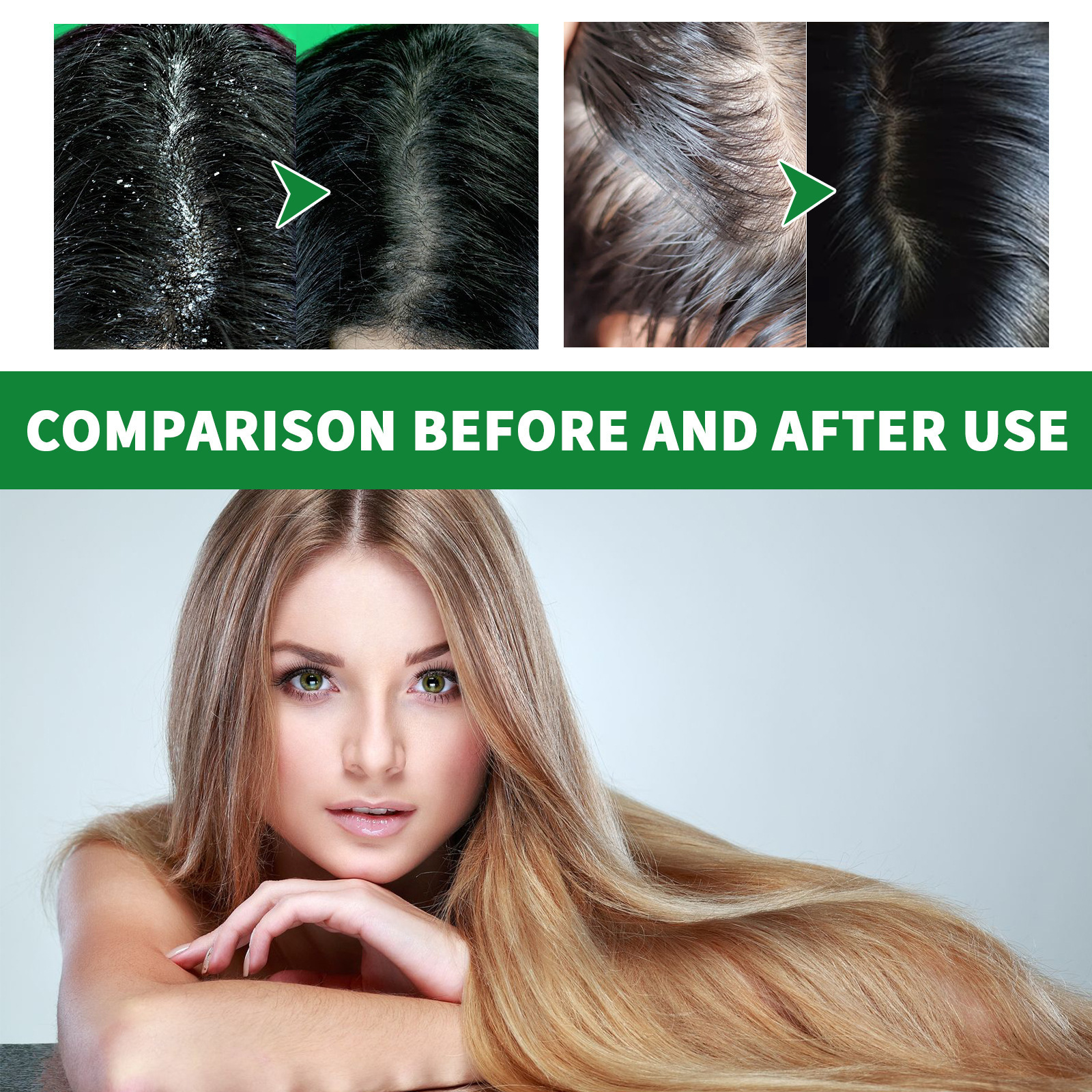 Soft Fluffy Cleansing Scalp Dandruff Shampoo - Image 2