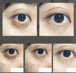 Anti Wrinkle Eye Cream - Image 5