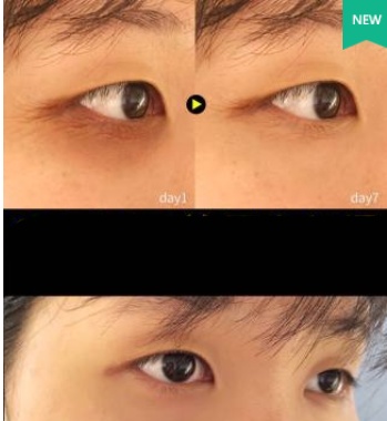 Anti Wrinkle Eye Cream - Image 3